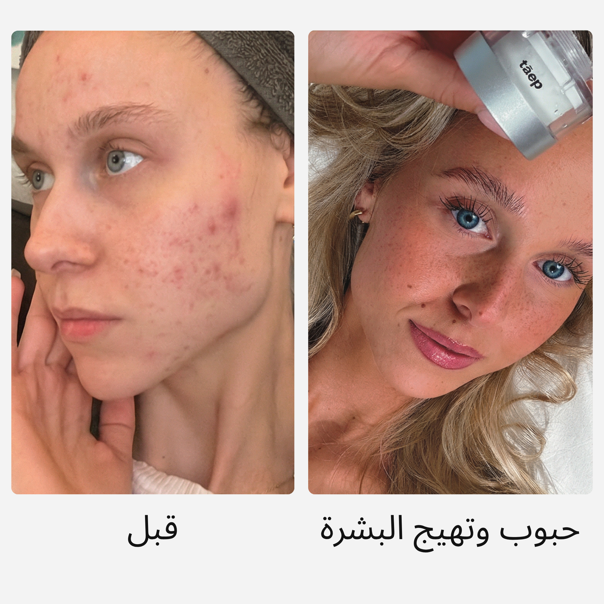 اشعر بالفرق على بشرتك.