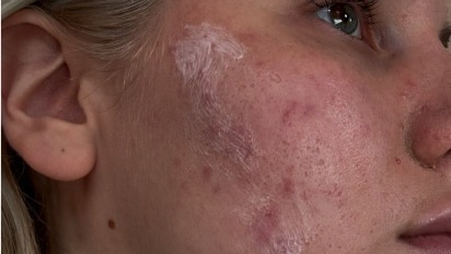 Before image