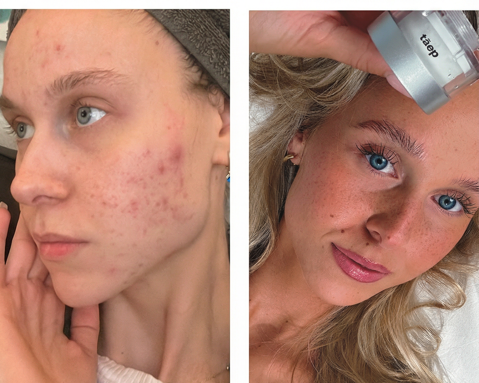 Feel the difference on your skin.