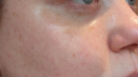 Before image