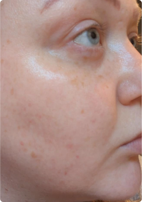 After image