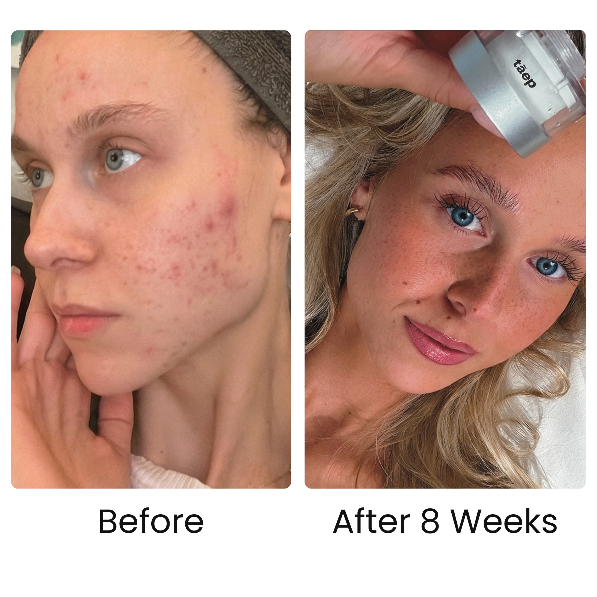 Spüren Sie den Unterschied auf Ihrer Haut.